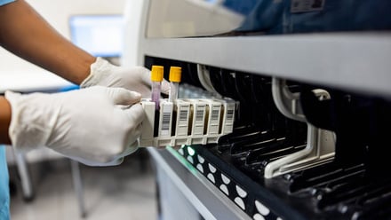 Blood samples_lab_diagnostic.jpg