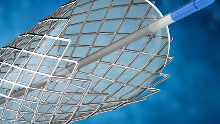 webimage-medical-device_stent_impurity_20241208.png